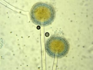 ④カビによる健康被害